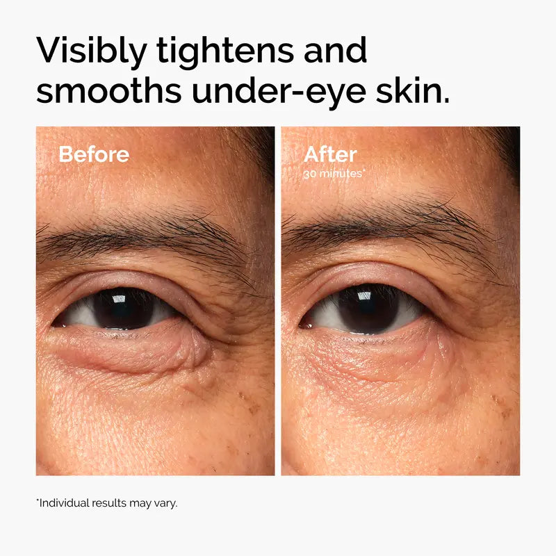 Lacto-PDRN 4% + B9 Firming & Brightening Eye Cream